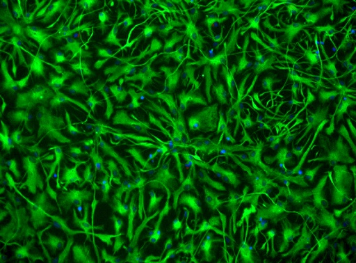 [26sk134] Endothelial Cells