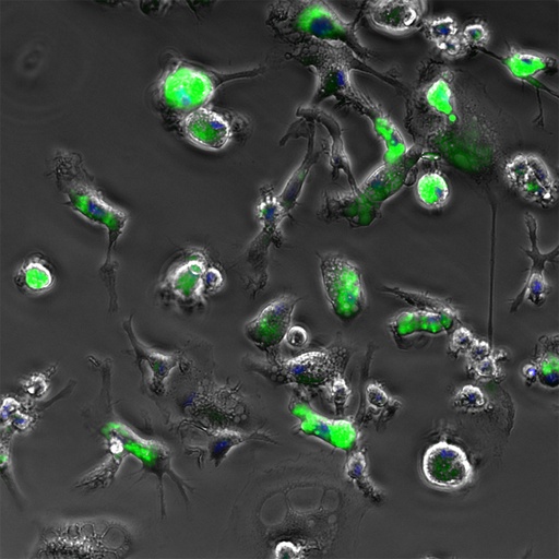 [26sk140] Disorder Cells(Microglia)