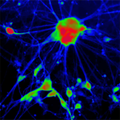 [26sk152] Reporter Cells (Microglia)