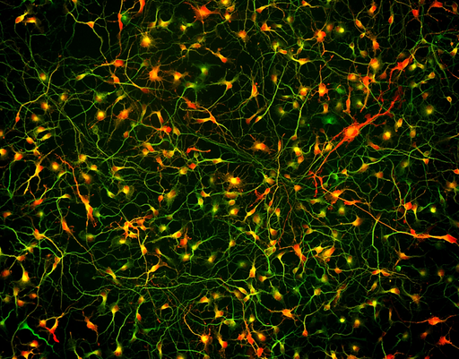 [26sk165] BrainFast Neuronal Maturation Supplement Motor