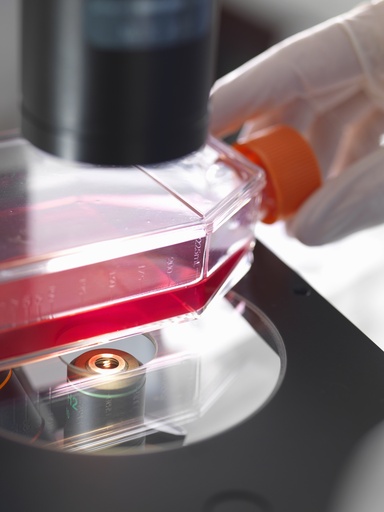 [SA-CAS9-28] SH-SY5Y Cell Line Stably Expressing Human tau 2N4R isoform Wildtype
